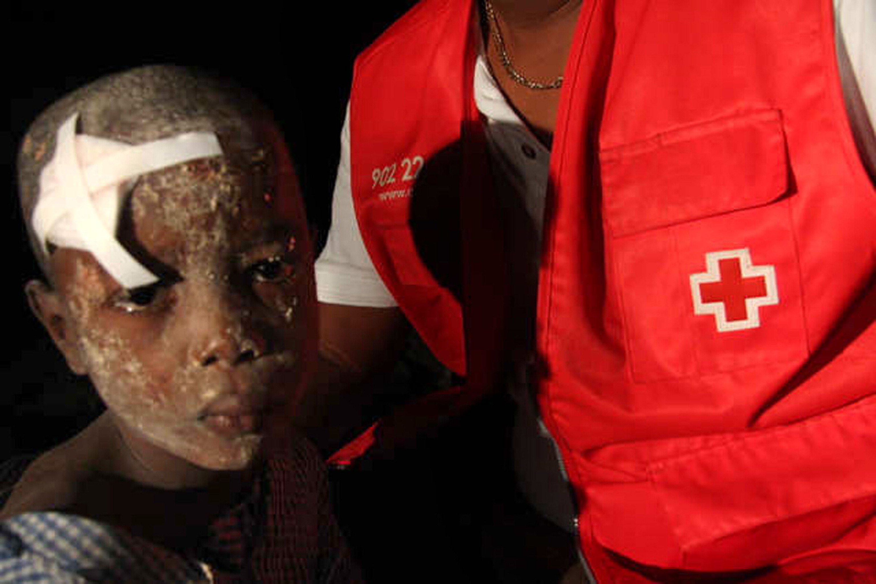 Un bambino ferito nel terremoto che ha colpito Haiti