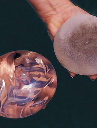 
 Protesi in silicone per il seno